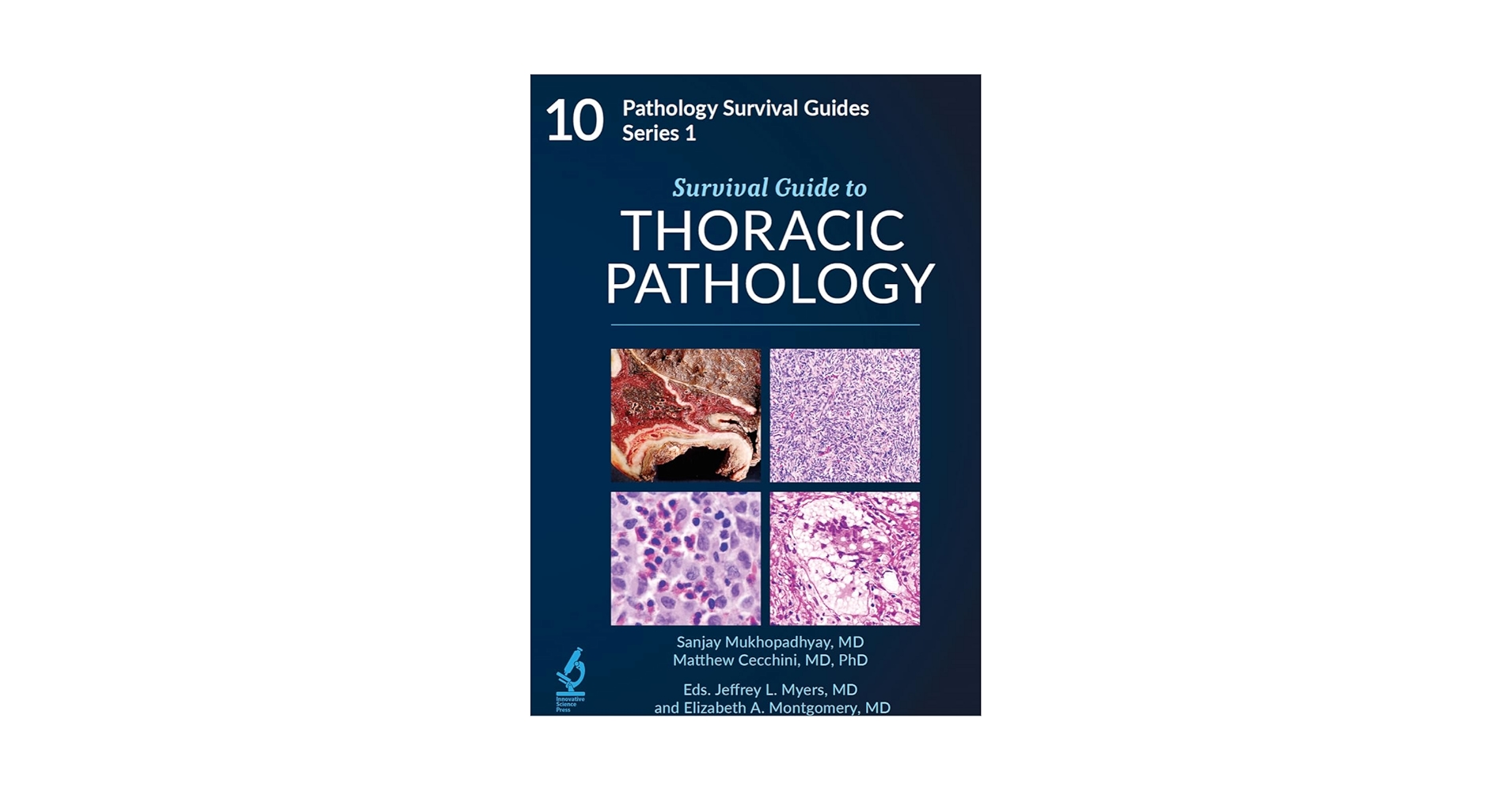 Survival Guide to Thoracic Pathology【新品】 Survival Guide to Thoracic Pathology: Sanjay Mukhopadhyay
